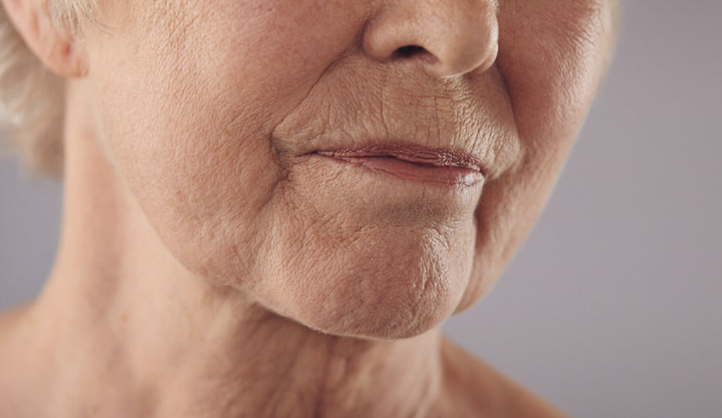 Bệnh khô miệng ở người lớn tuổi